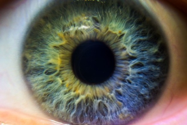 Сетчатка глаза человека